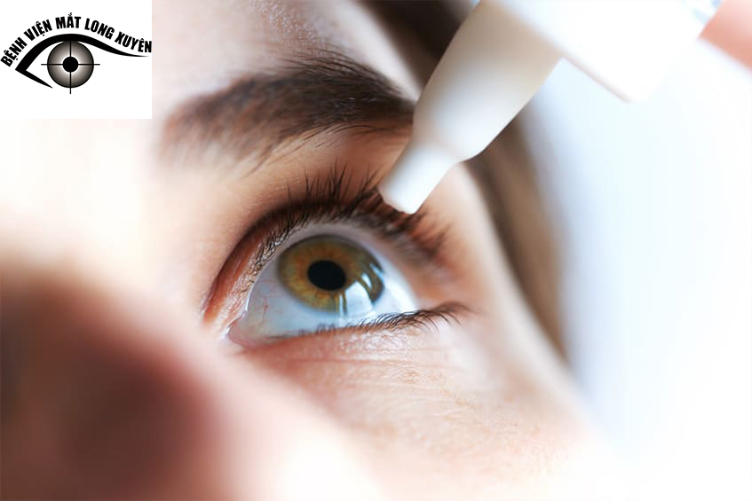 Bác sĩ điều trị đau mắt đỏ do vi khuẩn bằng thuốc kháng sinh dưới dạng thuốc nhỏ mắt, thuốc mỡ hoặc thuốc viên.